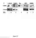 Fig. 13 - DETECTION OF PHOSPHORYLATED eIF2-alpha AS A DIAGNOSTIC TEST FOR EFFICACY AND SENSITIVITY OF TRANSLATION INITIATION INHIBITORS IN THE TREATMENT OF CANCER AND OTHER PROLIFERATIVE DISEASES