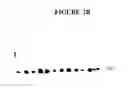 Fig. 04 - Method and kits for detecting cerebrospinal fluid in a sample