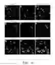 Fig. 22 - Pain signaling molecules