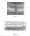 Fig. 06 - Poly filled substrate contact on SOI structure