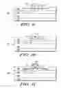 Fig. 05 - Method for improving self-aligned silicide extendibility with spacer recess using an aggregated spacer recess etch (ASRE) integration