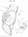 Fig. 35 - Powered paint removal tool