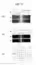 Fig. 22 - Fm signal demodulation method and device thereof