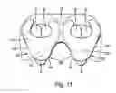 Fig. 06 - Plate-link chain