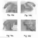 Fig. 15 - Glatiramer acetate for use as an immuno-modulatory agent