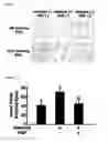 Fig. 02 - Differentiation- or regeneration-inducing agent for alveoli