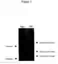Fig. 04 - Method of treating arthritis and promoting growth of articular chondrocytes