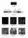 Fig. 10 - Dynamin mediated diseases and associated methods and products
