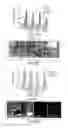 Fig. 12 - Dynamin mediated diseases and associated methods and products