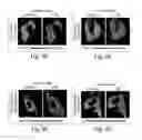 Fig. 16 - Dynamin mediated diseases and associated methods and products