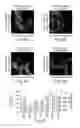 Fig. 17 - Dynamin mediated diseases and associated methods and products