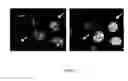 Fig. 06 - Nucleic acids useful for triggering tumor cell lethality