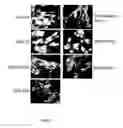 Fig. 08 - Nucleic acids useful for triggering tumor cell lethality