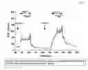 Fig. 02 - Method and composition for treatment of diabetes, hypertension, chronic heart failure and fluid retentive states
