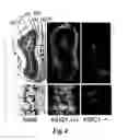 Fig. 05 - Novel compositions and methods for modulation of the acid-sensing ion channel (ASIC) for the treatment of anxiety and drug addiction