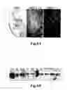 Fig. 07 - Novel compositions and methods for modulation of the acid-sensing ion channel (ASIC) for the treatment of anxiety and drug addiction