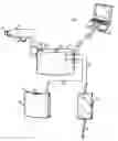 Fig. 01 - Heart assist system