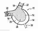 Fig. 01 - Method for making a blood pump and pumping blood