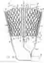 Fig. 08 - Cardiac harness having diagnostic sensors and method of use