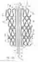 Fig. 09 - Cardiac harness having diagnostic sensors and method of use