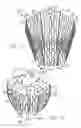 Fig. 12 - Cardiac harness having diagnostic sensors and method of use