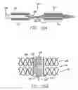 Fig. 22 - Cardiac harness having diagnostic sensors and method of use