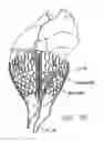 Fig. 30 - Cardiac harness having diagnostic sensors and method of use