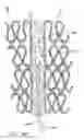Fig. 35 - Cardiac harness having diagnostic sensors and method of use