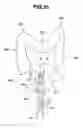Fig. 26 - Endoscope inserting section with case, and method for removing endoscope inserting section