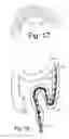 Fig. 09 - MANIPULABLE GUIDE DEVICE