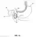 Fig. 11 - Positioning system for manipulating a channel within a medical device