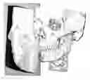 Fig. 01 - Method for deriving a treatment plan for orthognatic surgery and devices therefor