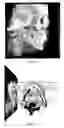 Fig. 03 - Method for deriving a treatment plan for orthognatic surgery and devices therefor