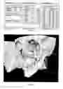 Fig. 04 - Method for deriving a treatment plan for orthognatic surgery and devices therefor