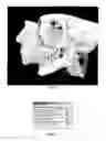 Fig. 05 - Method for deriving a treatment plan for orthognatic surgery and devices therefor