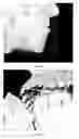 Fig. 06 - Method for deriving a treatment plan for orthognatic surgery and devices therefor