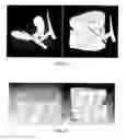 Fig. 07 - Method for deriving a treatment plan for orthognatic surgery and devices therefor