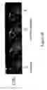 Fig. 07 - MRI imageable liposomes for the evaluation of treatment efficacy, thermal distribution, and demonstration of dose painting