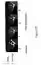 Fig. 09 - MRI imageable liposomes for the evaluation of treatment efficacy, thermal distribution, and demonstration of dose painting