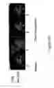 Fig. 10 - MRI imageable liposomes for the evaluation of treatment efficacy, thermal distribution, and demonstration of dose painting