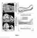 Fig. 18 - MRI imageable liposomes for the evaluation of treatment efficacy, thermal distribution, and demonstration of dose painting