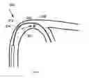 Fig. 04 - Magnetic field shape-adjustable medical device and method of using the same
