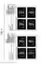 Fig. 06 - System and method for displaying image studies using hanging protocols with perspectives/views