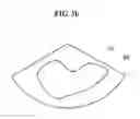 Fig. 05 - Ultrasonic scanning apparatus and method for diagnosing bladder