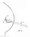 Fig. 09 - DEVICES AND METHODS FOR PERFORMING PROCEDURES ON A BREAST
