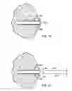 Fig. 13 - DEVICES AND METHODS FOR PERFORMING PROCEDURES ON A BREAST