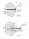 Fig. 14 - DEVICES AND METHODS FOR PERFORMING PROCEDURES ON A BREAST