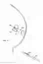 Fig. 15 - DEVICES AND METHODS FOR PERFORMING PROCEDURES ON A BREAST