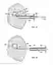 Fig. 25 - DEVICES AND METHODS FOR PERFORMING PROCEDURES ON A BREAST