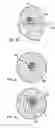 Fig. 26 - DEVICES AND METHODS FOR PERFORMING PROCEDURES ON A BREAST